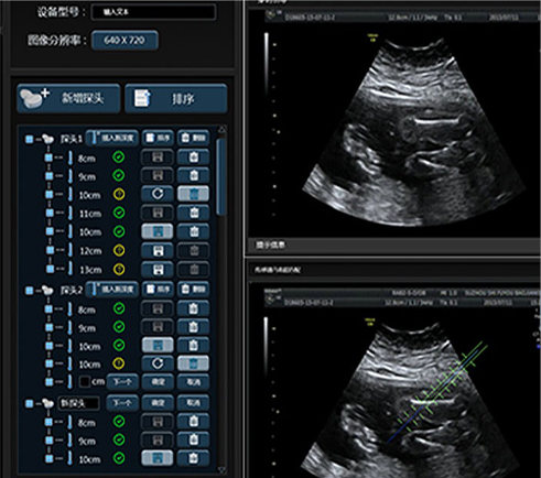 武漢睿影醫(yī)療科技超聲系統(tǒng)軟件界面設(shè)計